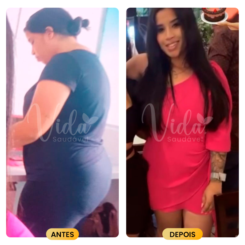 Antes-e-depois-Prancheta-1-copiar-10