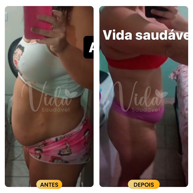 Antes e depois Prancheta 1 copiar 4