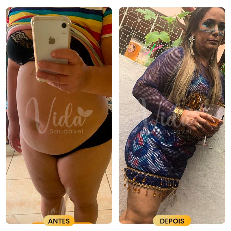 Antes e depois Prancheta 1 copiar 6