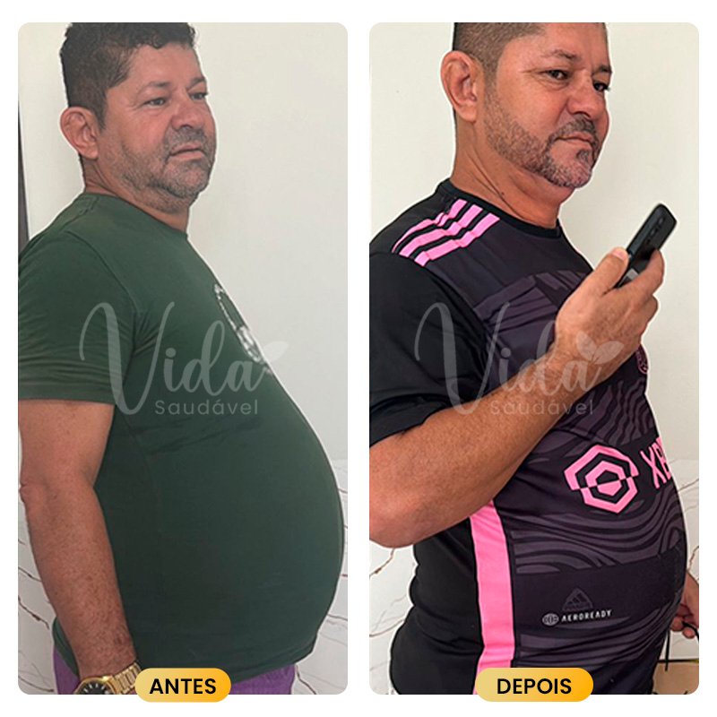 Antes e depois Prancheta 1 copiar 7