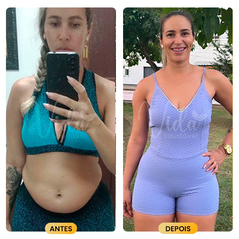 Antes e depois Prancheta 1 copiar 8