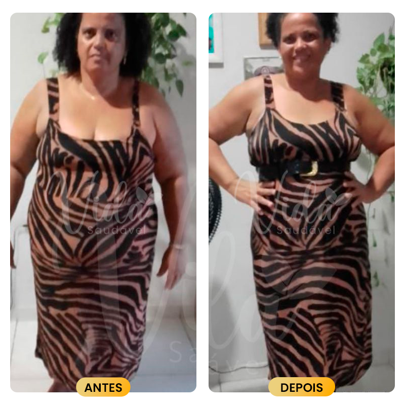 Antes-e-depois-Prancheta-1-copiar-9