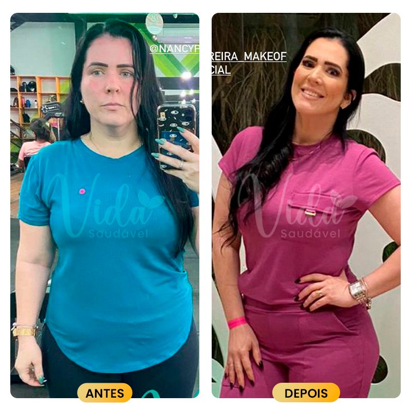 Antes e depois Prancheta 1 copiar