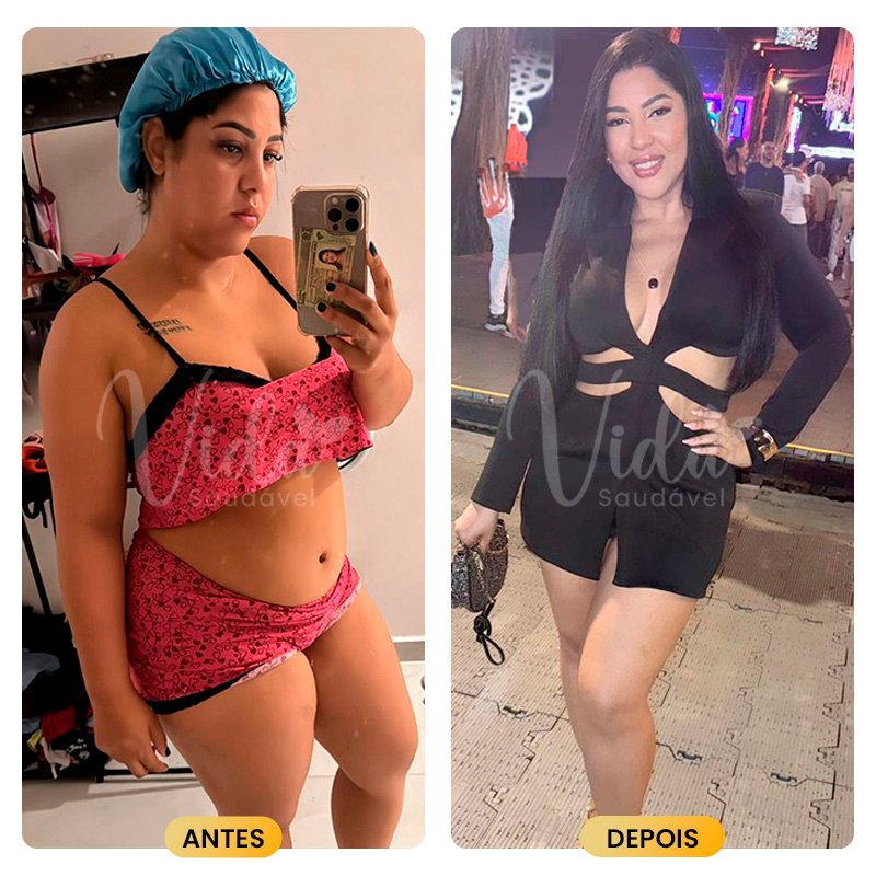 Antes e depois Prancheta 1